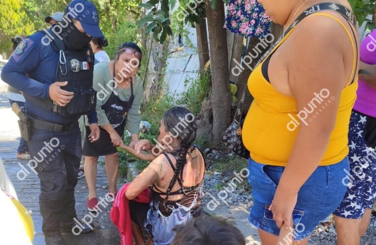 Abuela y nieta resultaron con quemaduras en el incendio de una urvan de Amojileca en Chilpancingo.