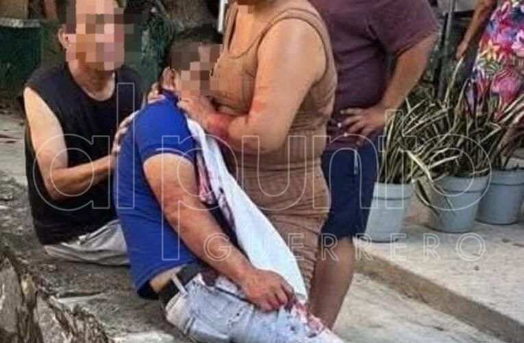 Muere hombre tras ataque con arma blanca presuntamente por su pareja en Zihuatanejo