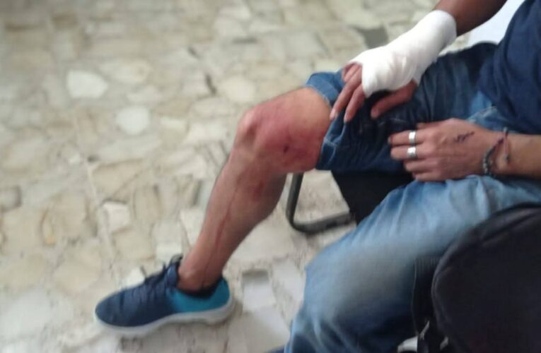 Atacan y lesionan a reportero en Atoyac durante presunto asalto